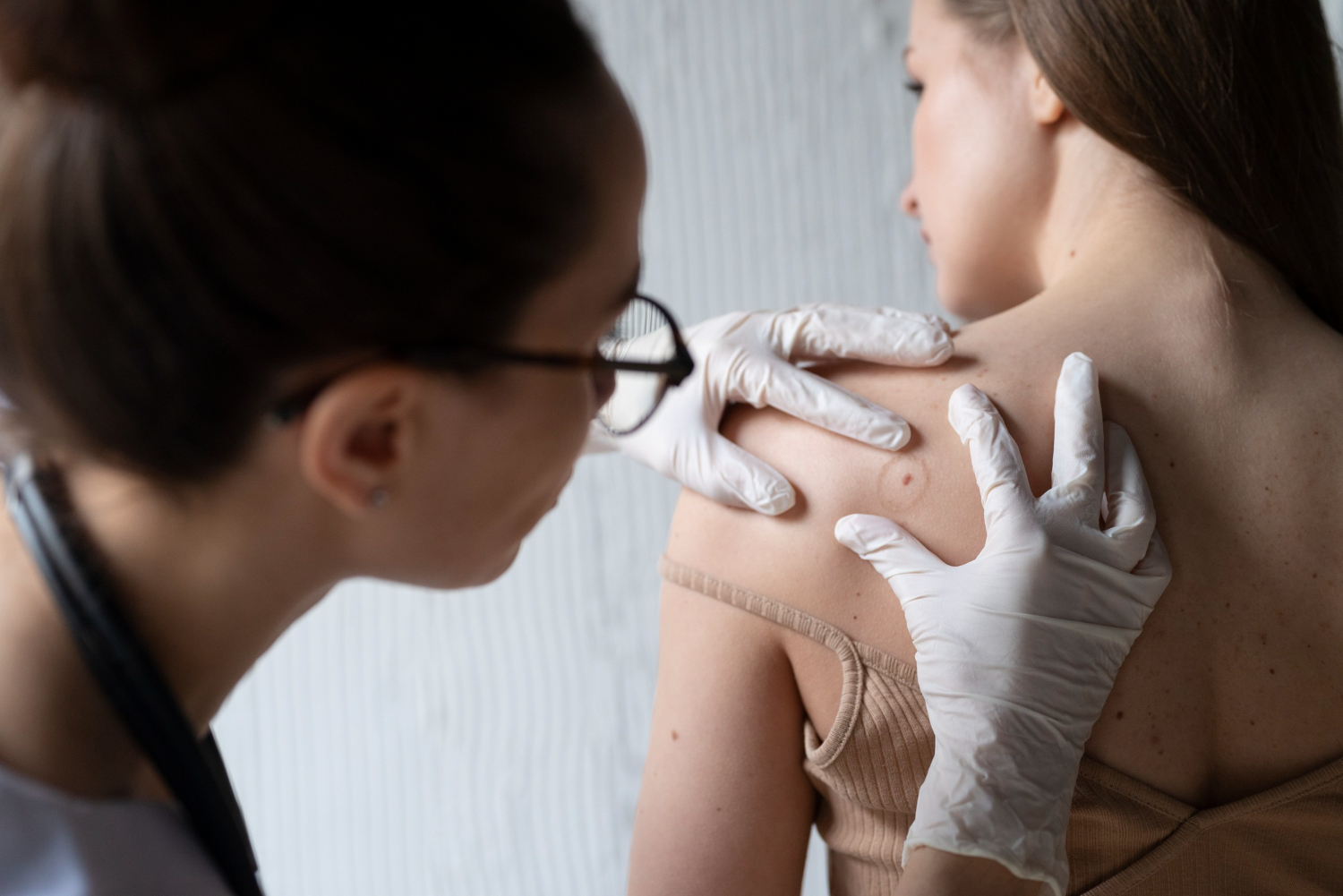 Vérification cancer de la peau