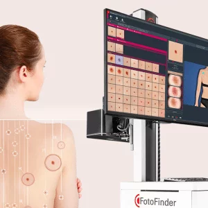 Fotofinder intelligence artificielle analyse lésions cutanées
