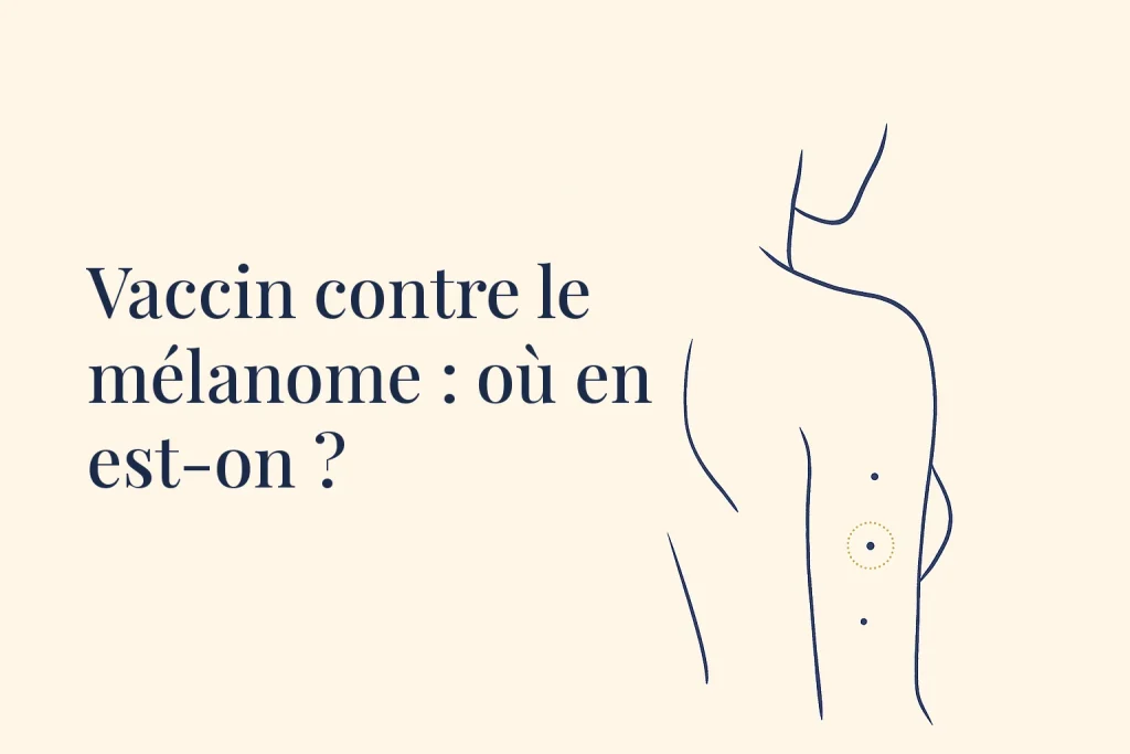 Consultation de dépistage et recherche sur le vaccin contre le mélanome